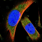 Immunofluorescent staining of human cell line U-251 MG shows localization to cytosol.