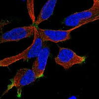 Anti-RIC8B Antibody
