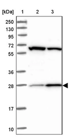 Lane 1: Marker [kDa] 250, 130, 95, 72, 55, 36, 28, 17, 10_br/_Lane 2: Human cell line RT-4_br/_Lane 3: Human cell line U-251MG sp
