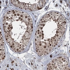 Immunohistochemical staining of human testis shows strong nuclear positivity in cells in seminiferous ducts.