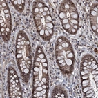 Immunohistochemical staining of human Rectum shows strong nuclear positivity in glandular cells.