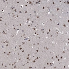 Immunohistochemical staining of human cerebral cortex shows strong nuclear positivity in neurons.