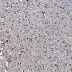 Immunohistochemical staining of human liver shows no positivity in hepatocytes as expected.