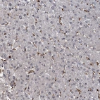 Immunohistochemical staining of human liver shows no positivity in hepatocytes as expected.