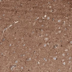 Immunohistochemical staining of human cerebral cortex shows moderate neuropil positivity