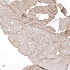 Immunohistochemical staining of human skeletal muscle shows weak positivity in myocytes.