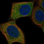 Immunofluorescent staining of human cell line HaCaT shows localization to cytosol.