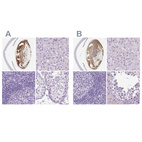 Anti-LGSN Antibody