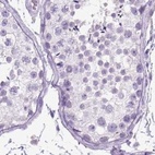 Anti-LGSN Antibody