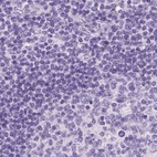 Immunohistochemical staining of human lymph node using Anti-LGSN antibody HPA039983.