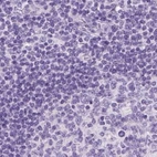 Immunohistochemical staining of human lymph node using Anti-LGSN antibody HPA039983.