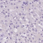 Immunohistochemical staining of human liver using Anti-LGSN antibody HPA039983.