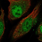 Anti-LGSN Antibody