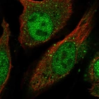 Immunofluorescent staining of human cell line U-2 OS shows localization to nucleoplasm & vesicles.