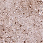 Anti-RARS2 Antibody