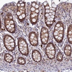 Anti-TAB1 Antibody