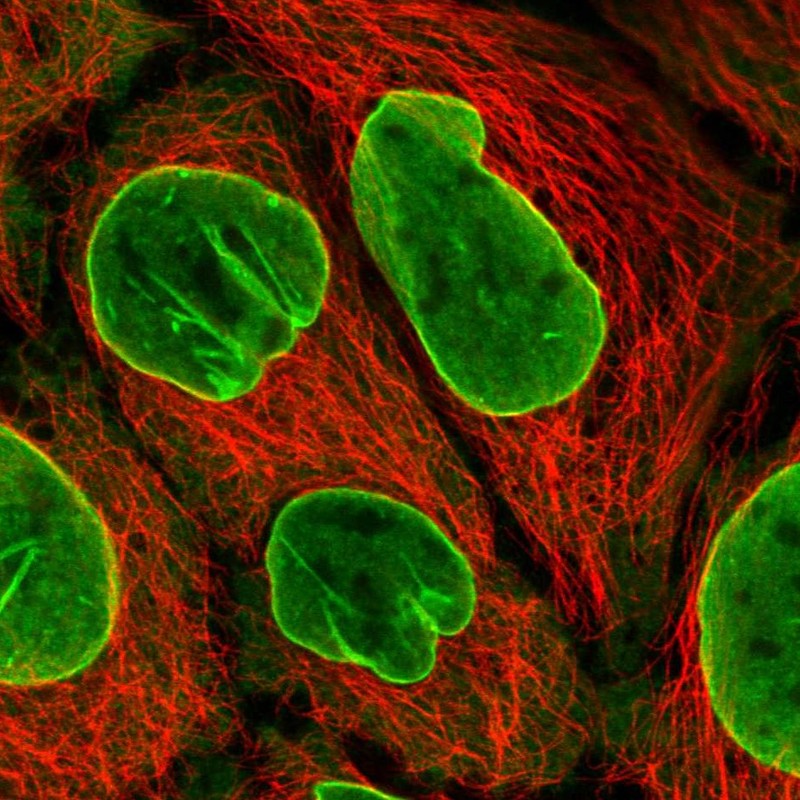 Anti-EIF2B4 Antibody
