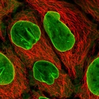 Anti-EIF2B4 Antibody