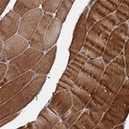 Anti-SLC10A7 Antibody