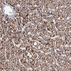Immunohistochemical staining of human Liver shows strong granular cytoplasmic positivity in hepatocytes.