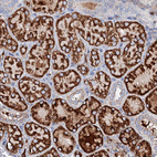 Immunohistochemical staining of human Kidney shows strong granular cytoplasmic positivity in cells in tubules.