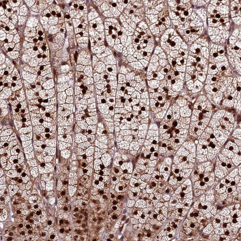 Anti-TRMT112 Antibody