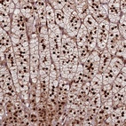 Anti-TRMT112 Antibody