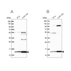 Western blot analysis using Anti-TRMT112 antibody HPA040006 (A) shows similar pattern to independent antibody HPA039901 (B).