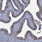 Anti-WDR66 Antibody