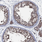 Immunohistochemical staining of human testis shows moderate to strong cytoplasmic positivity in cells in seminiferous ducts.