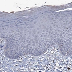 Immunohistochemical staining of human skin shows no positivity in squamous epithelial cells as expected.