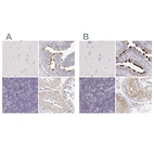 Immunohistochemical staining of human cerebral cortex, fallopian tube, lymph node and testis using Anti-NME9 antibody HPA040000 (A) shows similar protein distribution across tissues to independent antibody HPA043881 (B).