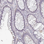 Immunohistochemical staining of human colon shows low expression as expected.
