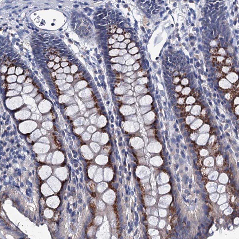 Anti-ANKRD33 Antibody