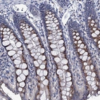 Anti-ANKRD33 Antibody