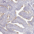 Immunohistochemical staining of human fallopian tube shows high expression.