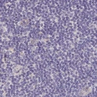 Immunohistochemical staining of human lymph node using Anti-NME9 antibody HPA040000.