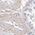 Immunohistochemical staining of human testis using Anti-NME9 antibody HPA040000.