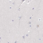 Immunohistochemical staining of human cerebral cortex using Anti-NME9 antibody HPA040000.
