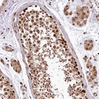 Anti-PDS5B Antibody