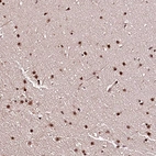 Immunohistochemical staining of human Cerebellum shows strong nuclear positivity in glial and neuronal cells.