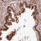 Immunohistochemical staining of human Prostate shows strong nuclear positivity in glandular cells.