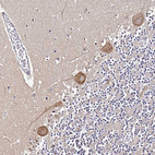Immunohistochemical staining of human cerebellum shows moderate cytoplasmic positivity in Purkinje cells.