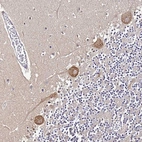 Immunohistochemical staining of human cerebellum shows moderate cytoplasmic positivity in Purkinje cells.