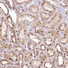 Immunohistochemical staining of human Kidney shows moderate nuclear positivity in cells in tubules.