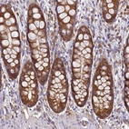Immunohistochemical staining of human rectum shows moderate cytoplasmic positivity in glandular cells.
