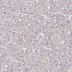 Immunohistochemical staining of human liver shows very weak cytoplasmic positivity in hepatocytes.