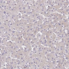 Immunohistochemical staining of human liver shows very weak cytoplasmic positivity in hepatocytes.