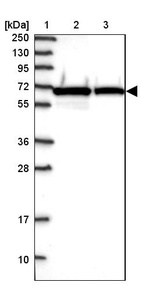 Lane 1: Marker [kDa] 250, 130, 95, 72, 55, 36, 28, 17, 10_br/_Lane 2: Human cell line RT-4_br/_Lane 3: Human cell line U-251MG sp