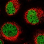 Immunofluorescent staining of human cell line A-431 shows localization to nucleoplasm.